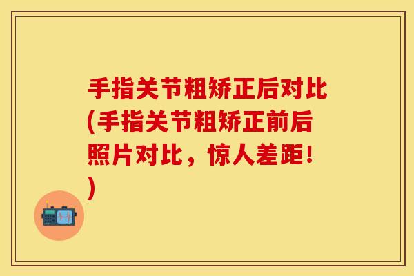 手指关节粗矫正后对比(手指关节粗矫正前后照片对比，惊人差距！)