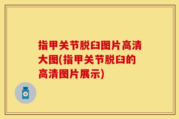 指甲关节脱臼图片高清大图(指甲关节脱臼的高清图片展示)