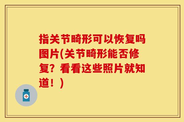 指关节畸形可以恢复吗图片(关节畸形能否修复？看看这些照片就知道！)