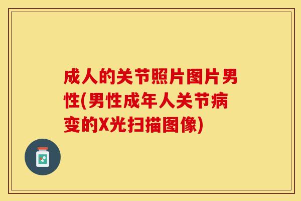 成人的关节照片图片男性(男性成年人关节病变的X光扫描图像)