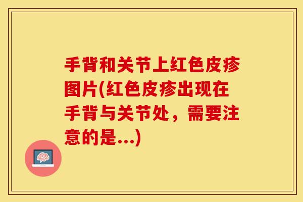 手背和关节上红色皮疹图片(红色皮疹出现在手背与关节处，需要注意的是...)