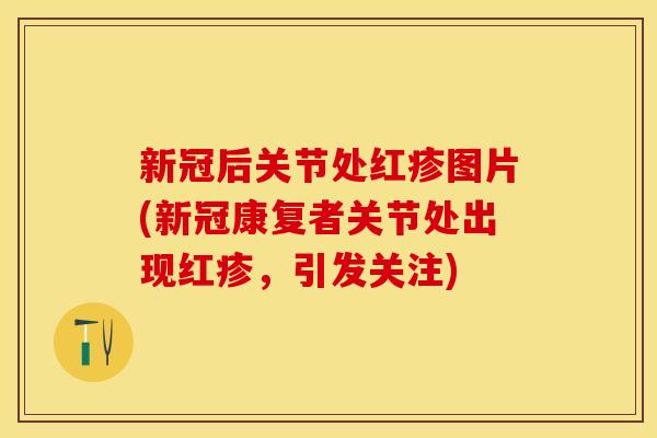 新冠后关节处红疹图片(新冠康复者关节处出现红疹，引发关注)