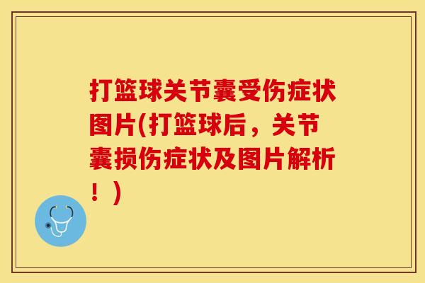 打篮球关节囊受伤症状图片(打篮球后，关节囊损伤症状及图片解析！)