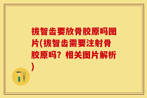 拔智齿要放骨胶原吗图片(拔智齿需要注射骨胶原吗？相关图片解析)