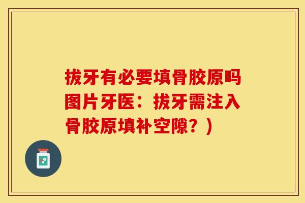 拔牙有必要填骨胶原吗图片牙医：拔牙需注入骨胶原填补空隙？)