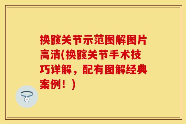 换髋关节示范图解图片高清(换髋关节手术技巧详解，配有图解经典案例！)