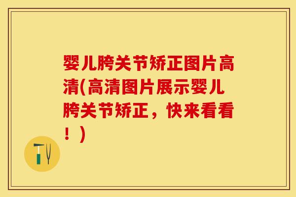 婴儿胯关节矫正图片高清(高清图片展示婴儿胯关节矫正，快来看看！)