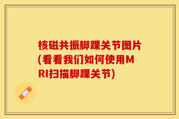 核磁共振脚踝关节图片(看看我们如何使用MRI扫描脚踝关节)