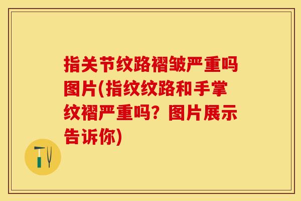 指关节纹路褶皱严重吗图片(指纹纹路和手掌纹褶严重吗？图片展示告诉你)-第1张图片-关节保镖