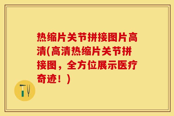 热缩片关节拼接图片高清(高清热缩片关节拼接图，全方位展示医疗奇迹！)