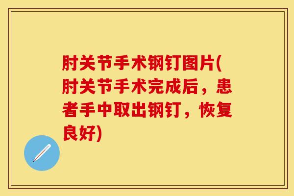 肘关节手术钢钉图片(肘关节手术完成后，患者手中取出钢钉，恢复良好)