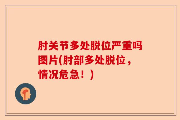 肘关节多处脱位严重吗图片(肘部多处脱位，情况危急！)