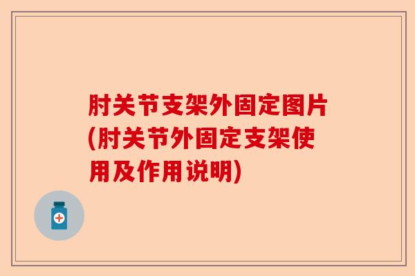 肘关节支架外固定图片(肘关节外固定支架使用及作用说明)