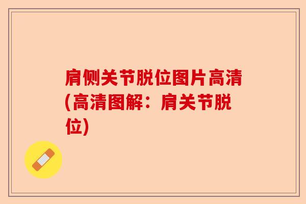 肩侧关节脱位图片高清(高清图解：肩关节脱位)