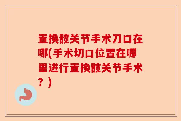 置换髋关节手术刀口在哪(手术切口位置在哪里进行置换髋关节手术？)