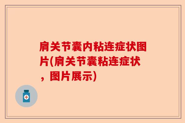 肩关节囊内粘连症状图片(肩关节囊粘连症状，图片展示)