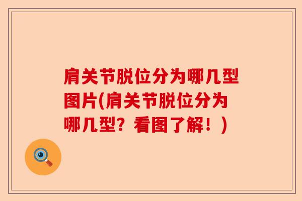 肩关节脱位分为哪几型图片(肩关节脱位分为哪几型？看图了解！)