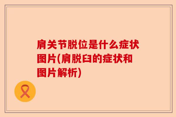 肩关节脱位是什么症状图片(肩脱臼的症状和图片解析)